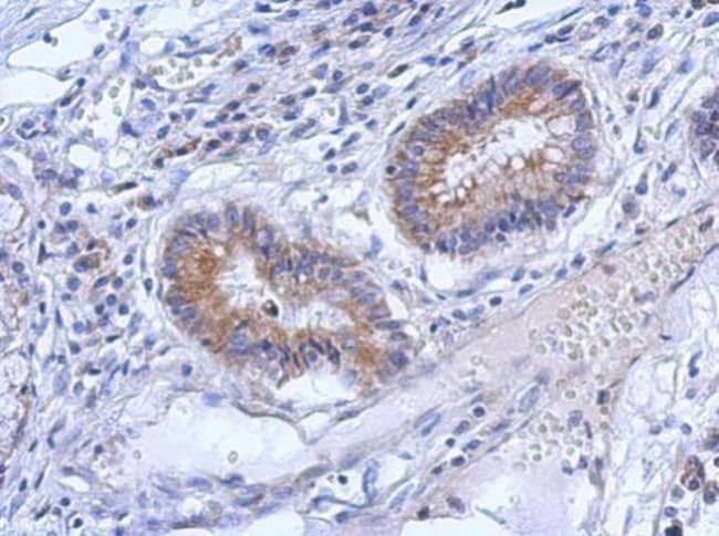100uL Polyclonal antibody, ZNF645, host