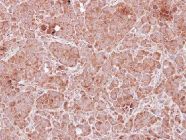100uL Polyclonal antibody, tropomodulin