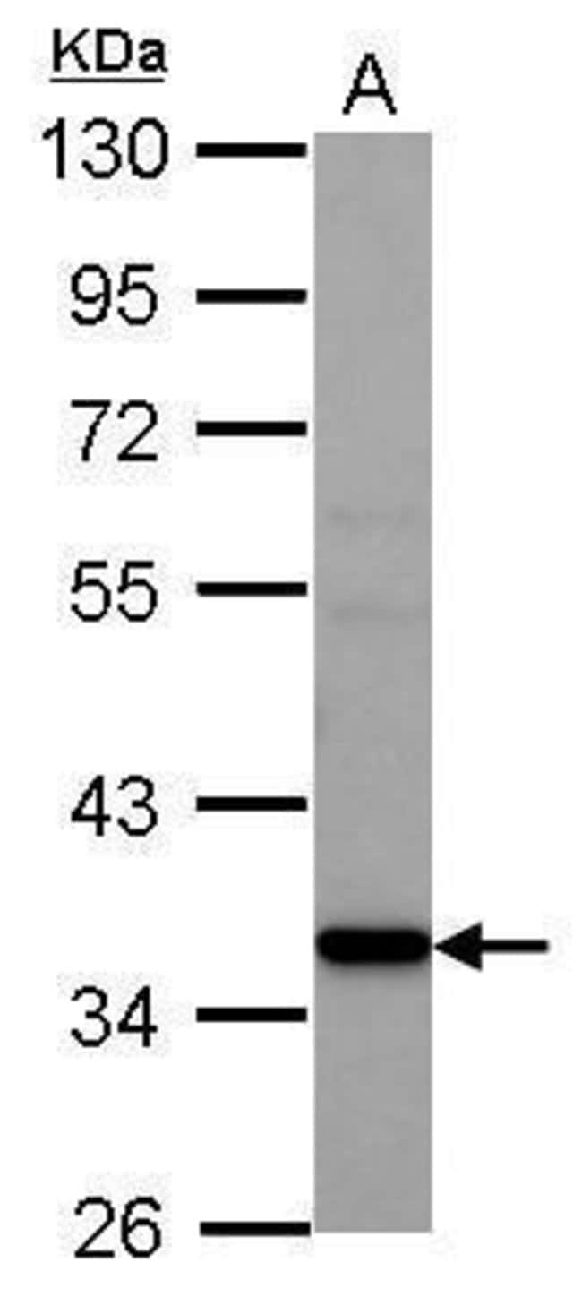100uL Polyclonal antibody, AMD1, host ra