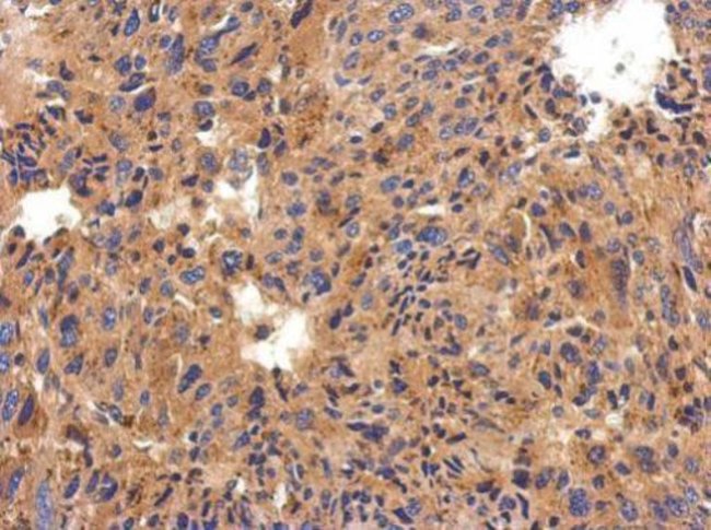 100uL Polyclonal antibody, C1 inhibitor,