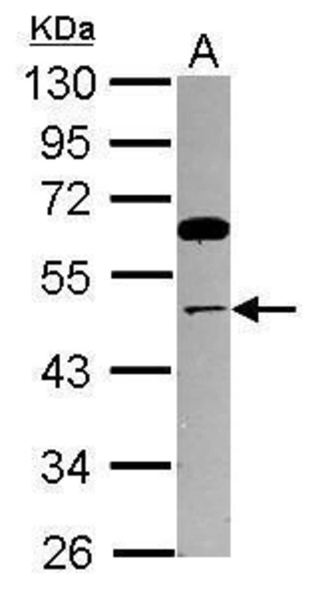 100uL Polyclonal antibody, triP13, host