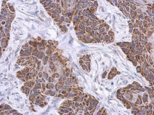 100uL Polyclonal antibody, PLCL2, host r