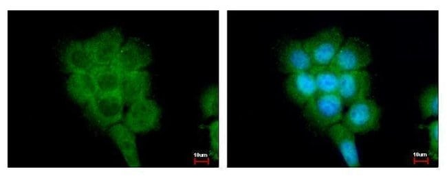 100uL Polyclonal antibody, FPGT, host ra