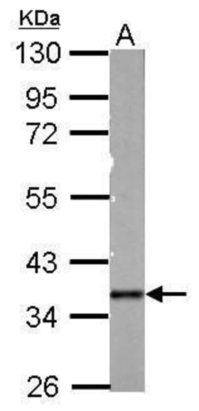 100uL Polyclonal antibody, PDLIM3, host