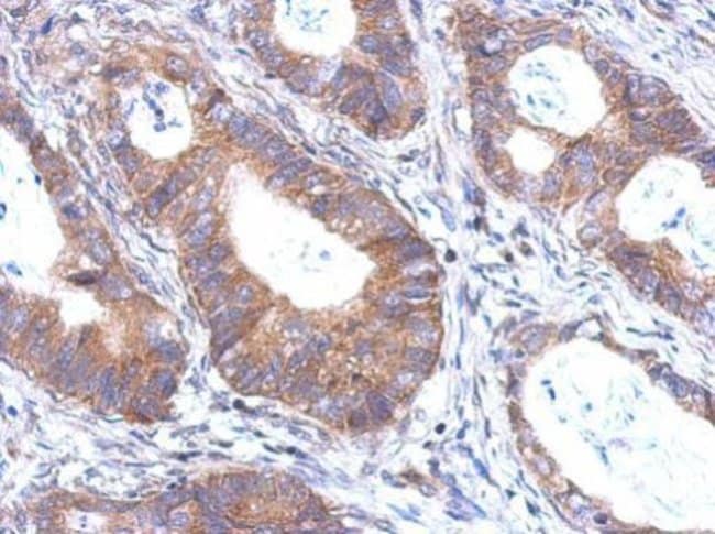 100uL Polyclonal antibody, BTBD6, host r