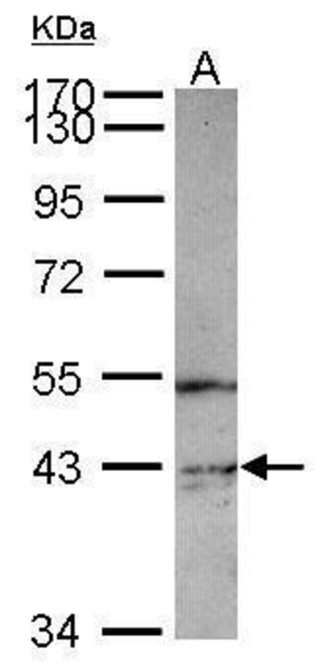 100uL Polyclonal antibody, PIP5K2 gamma,