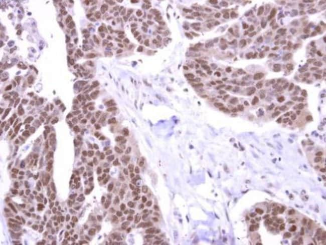 100uL Polyclonal antibody, Stk31, host r