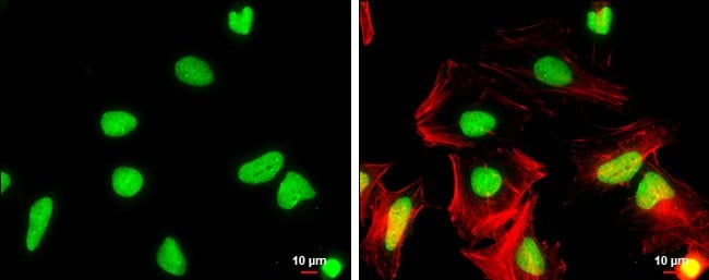 100uL Polyclonal antibody, Wdr62, host r