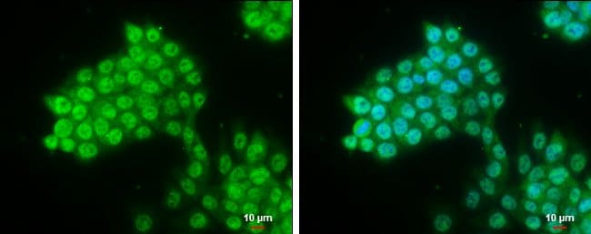100uL Polyclonal antibody, pygopus 2, ho