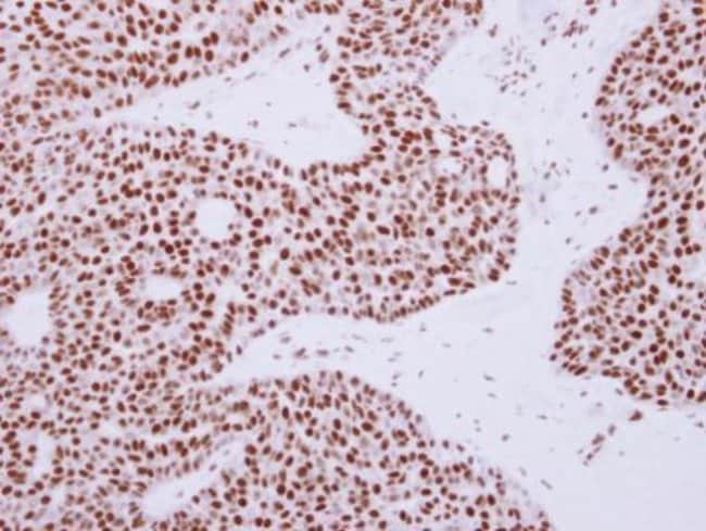 100uL Polyclonal antibody, Rad50, host r
