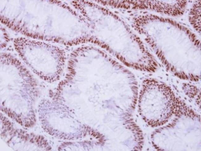 100uL Polyclonal antibody, Rad50, host r