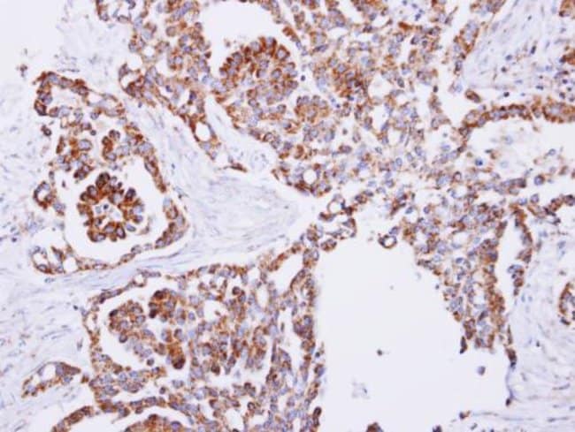 100uL Polyclonal antibody, PITRM1, host