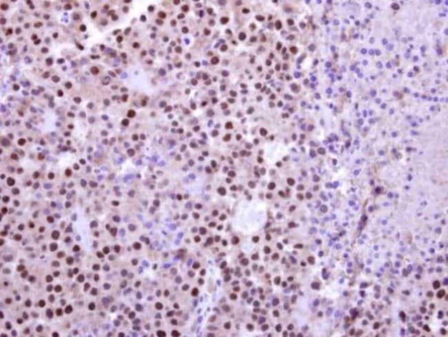 100uL Polyclonal antibody, UBR7, host ra