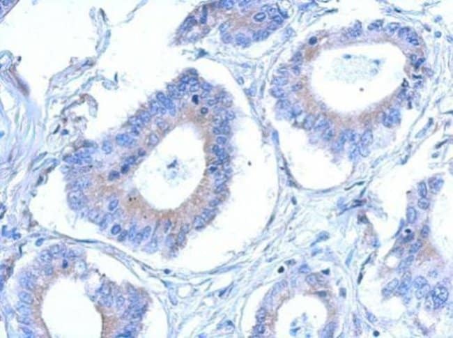 100uL Polyclonal antibody, CCDC28B, host