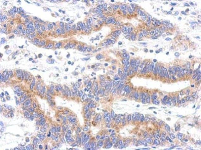 100uL Polyclonal antibody, HDHD3, host r