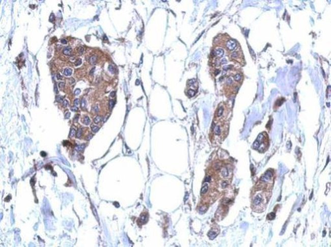 100uL Polyclonal antibody, DDX59, host r