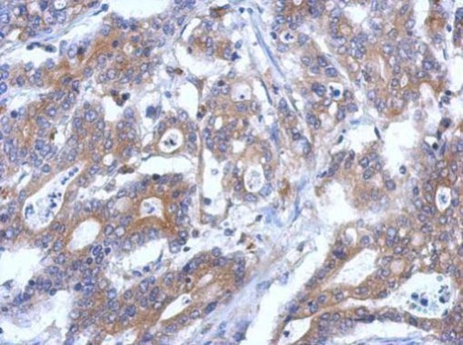 100uL Polyclonal antibody, RASSF4, host