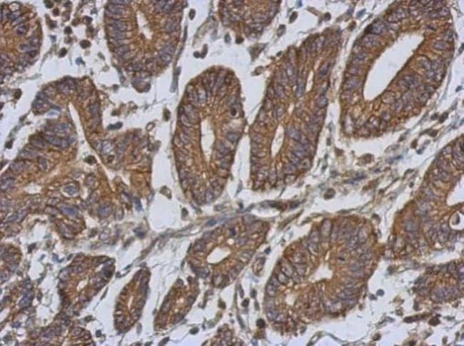 100uL Polyclonal antibody, EPLIN, host r
