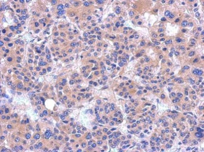 100uL Polyclonal antibody, PDZRN4, host