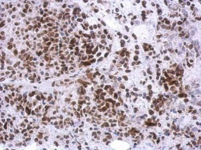 100uL Polyclonal antibody, C10orf93, hos