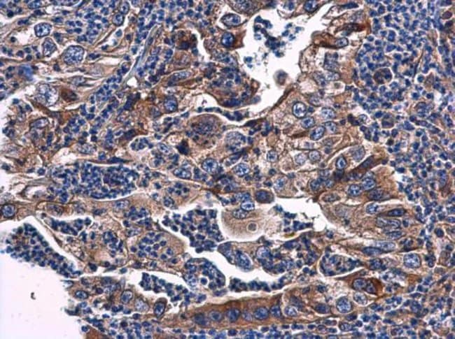 100uL Polyclonal antibody, phosphatase o
