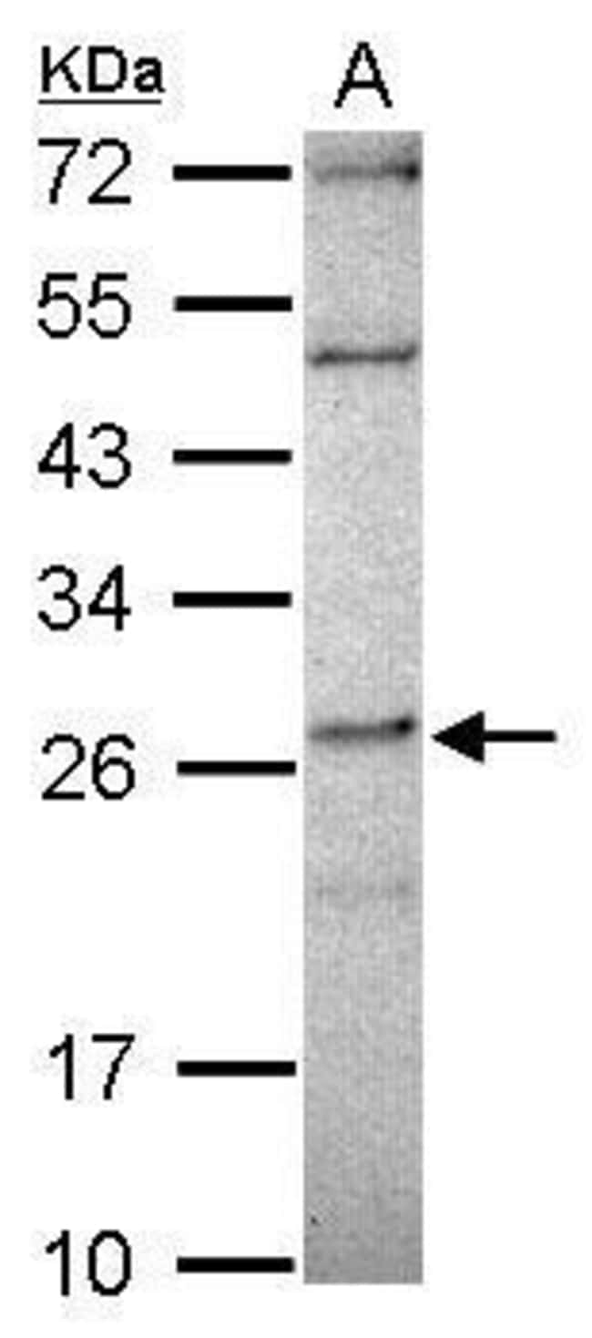 100uL Polyclonal antibody, DPCD, host ra