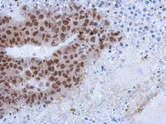 100uL Polyclonal antibody, ZCCHC4, host