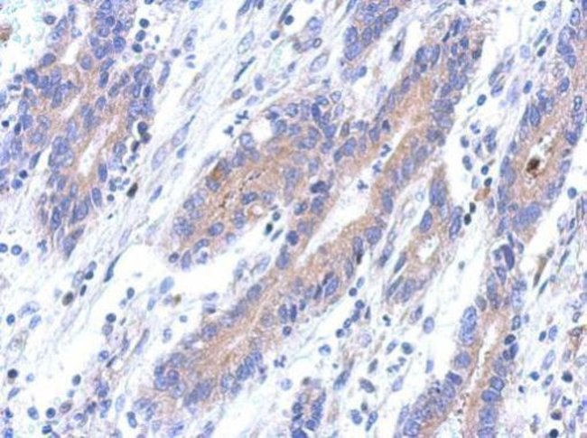 100uL Polyclonal antibody, C12orf41, hos