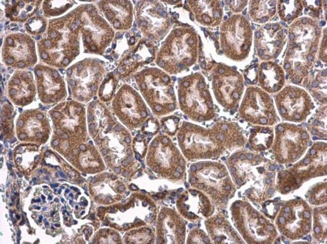 100uL Polyclonal antibody, CHCHD3, host