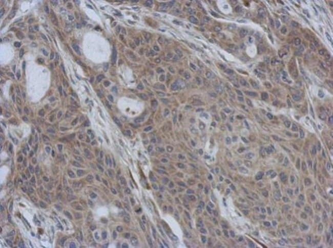 100uL Polyclonal antibody, CCDC90B, host