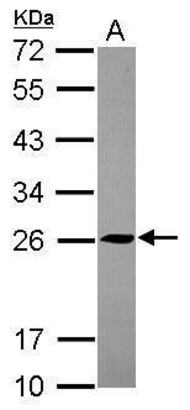 100uL Polyclonal antibody, TMED5, host r