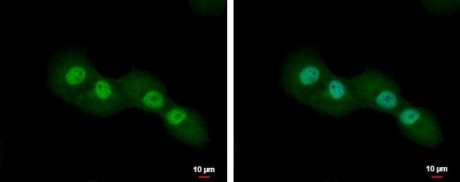 100uL Polyclonal antibody, CUTC, host ra