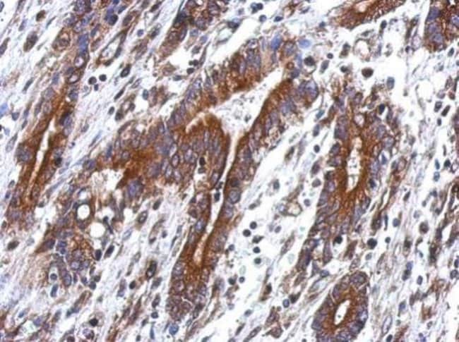 100uL Polyclonal antibody, tektin 4, hos
