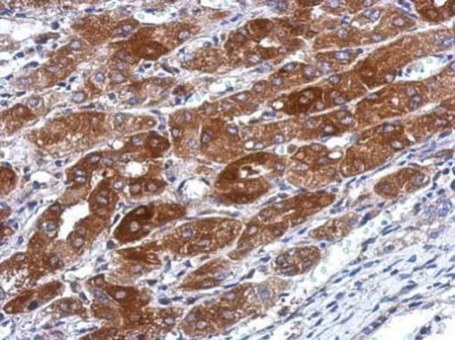 100uL Polyclonal antibody, transmembrane