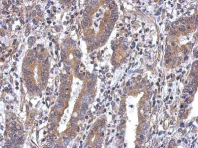 100uL Polyclonal antibody, MTG1, host ra