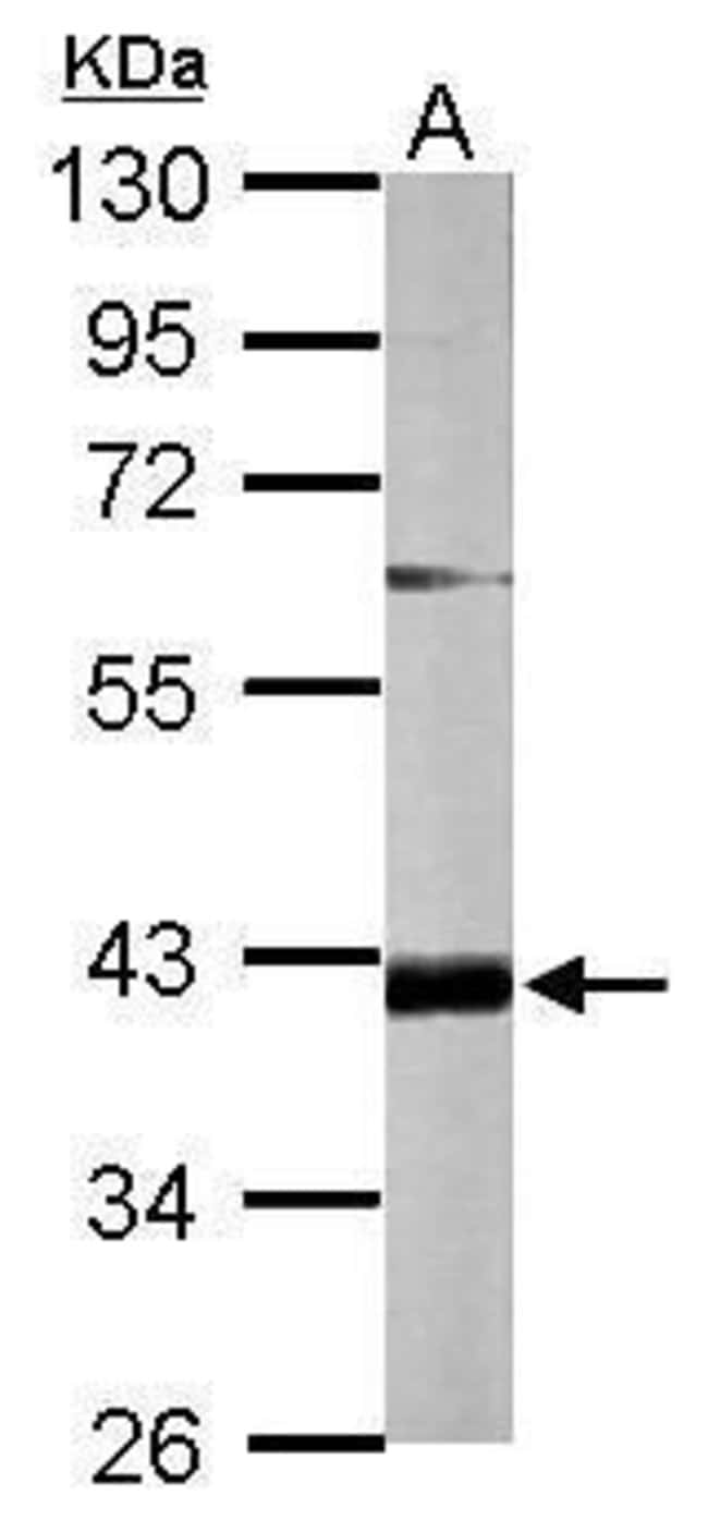 100uL Polyclonal antibody, FAM46D, host