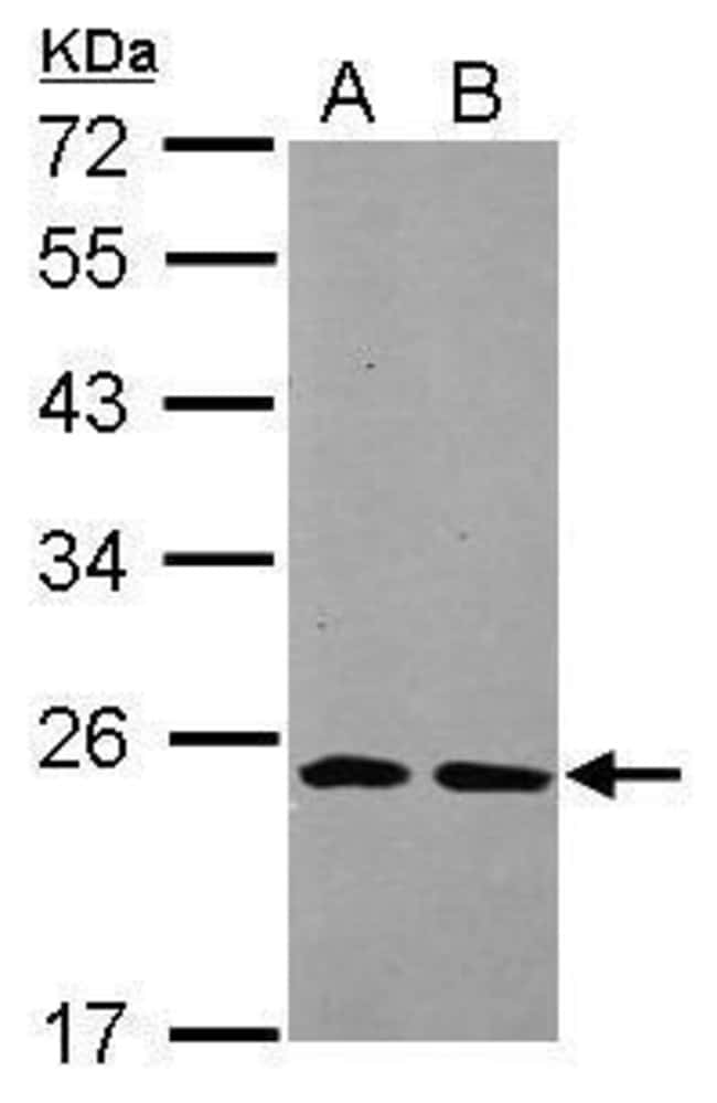 100uL Polyclonal antibody, THOC7, host r