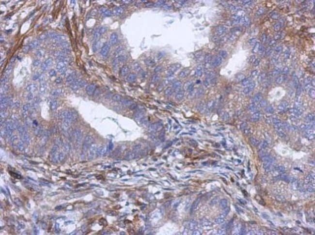 100uL Polyclonal antibody, PABP5, host r