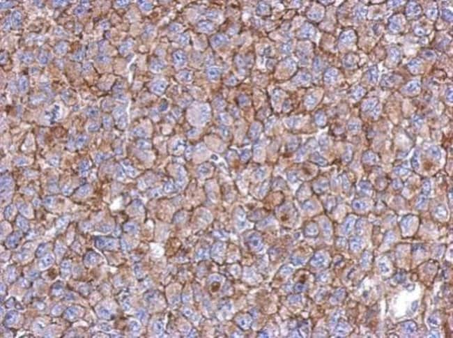 100uL Polyclonal antibody, KIAA0090, hos