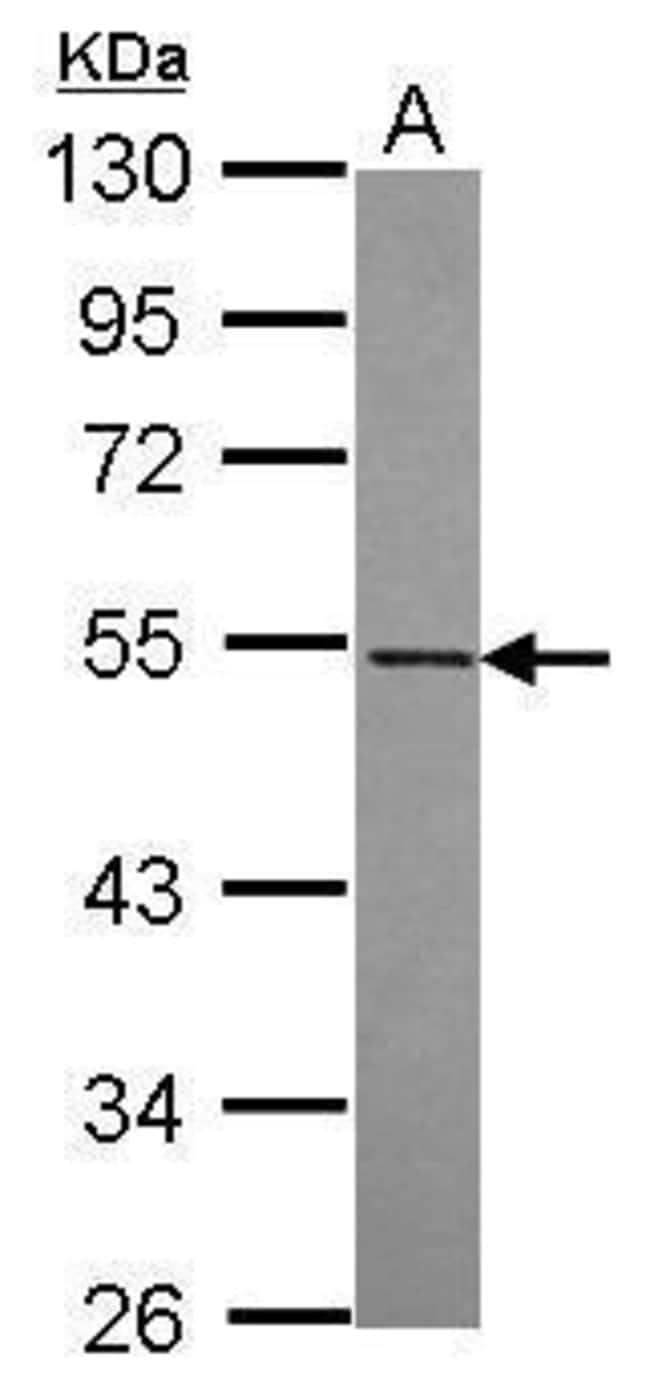 100uL Polyclonal antibody, RASGEF1A, hos