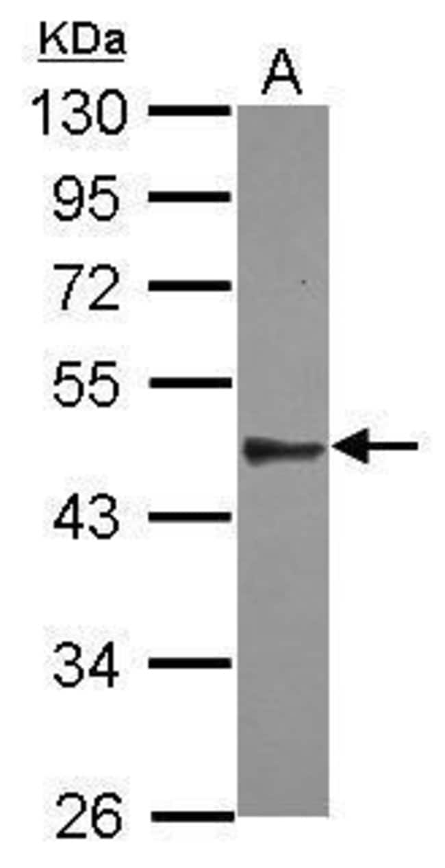 100uL Polyclonal antibody, SPATA6, host