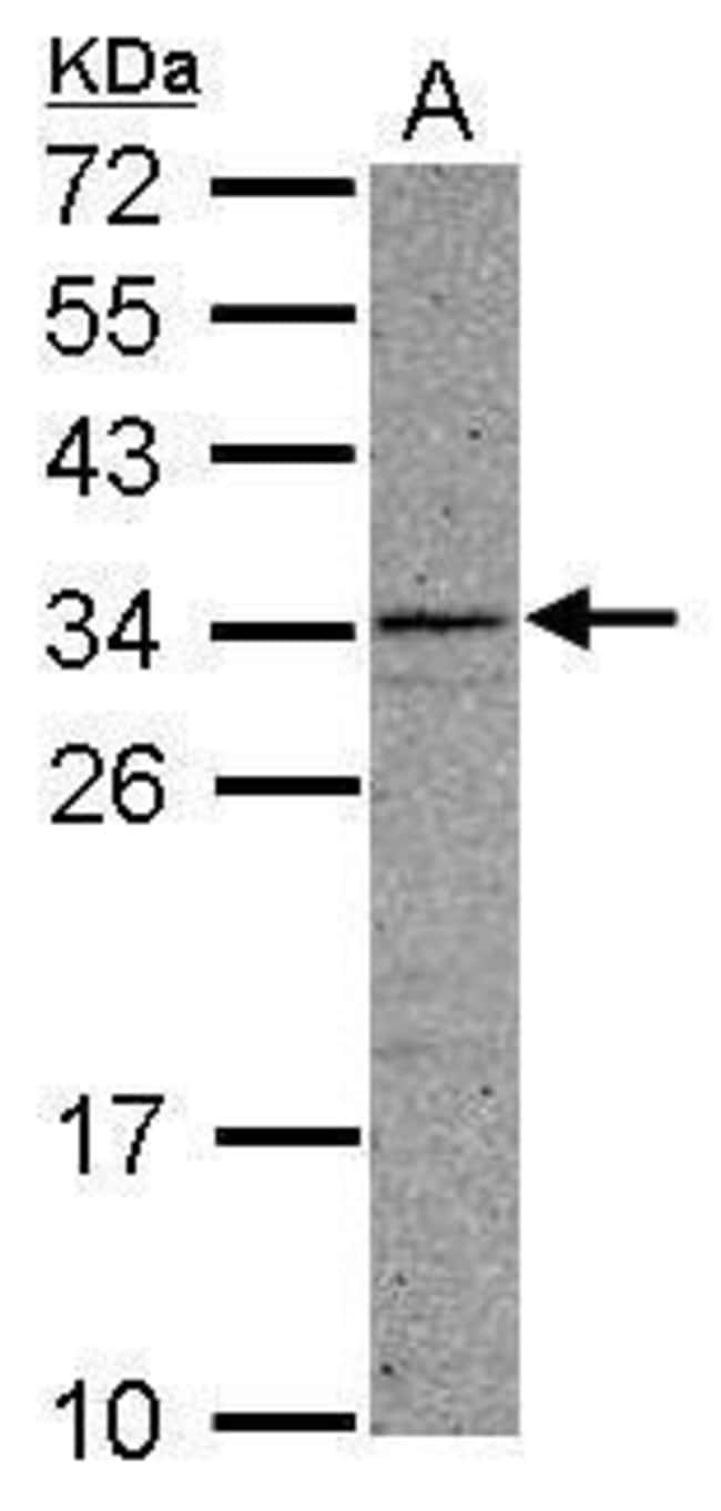 100uL Polyclonal antibody, CCDC107, host