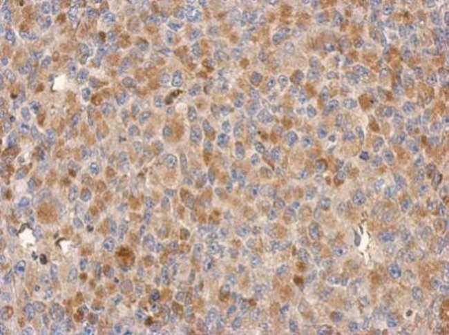 100uL Polyclonal antibody, C18orf34, hos