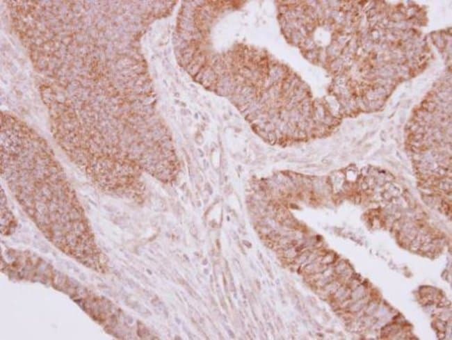 100uL Polyclonal antibody, MOSC2, host r