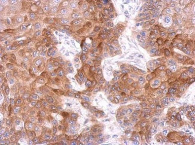 100uL Polyclonal antibody, FCHO1, host r