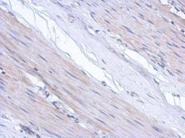 100uL Polyclonal antibody, ABCF3, host r