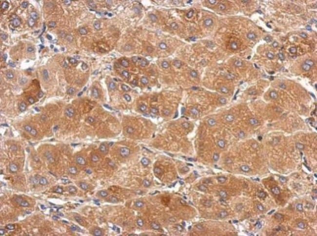 100uL Polyclonal antibody, SLC25A36, hos