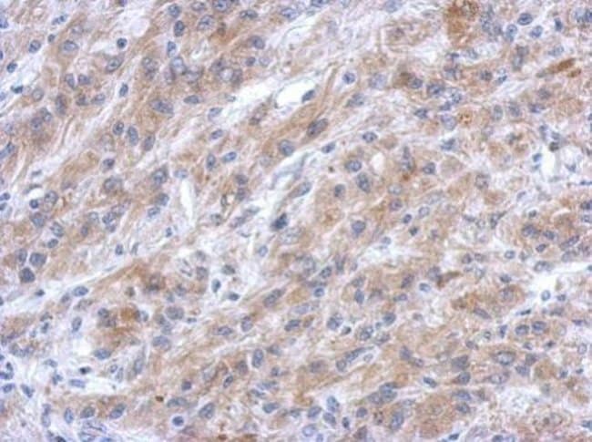 100uL Polyclonal antibody, EFHC2, host r