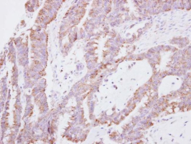 100uL Polyclonal antibody, SNF8, host ra