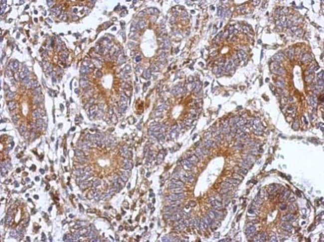 100uL Polyclonal antibody, SPAG8, host r